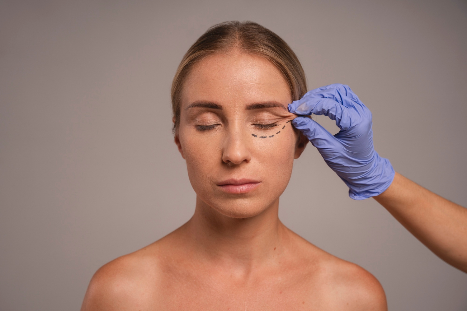 Estética do olhar adota abordagens para resultados naturais