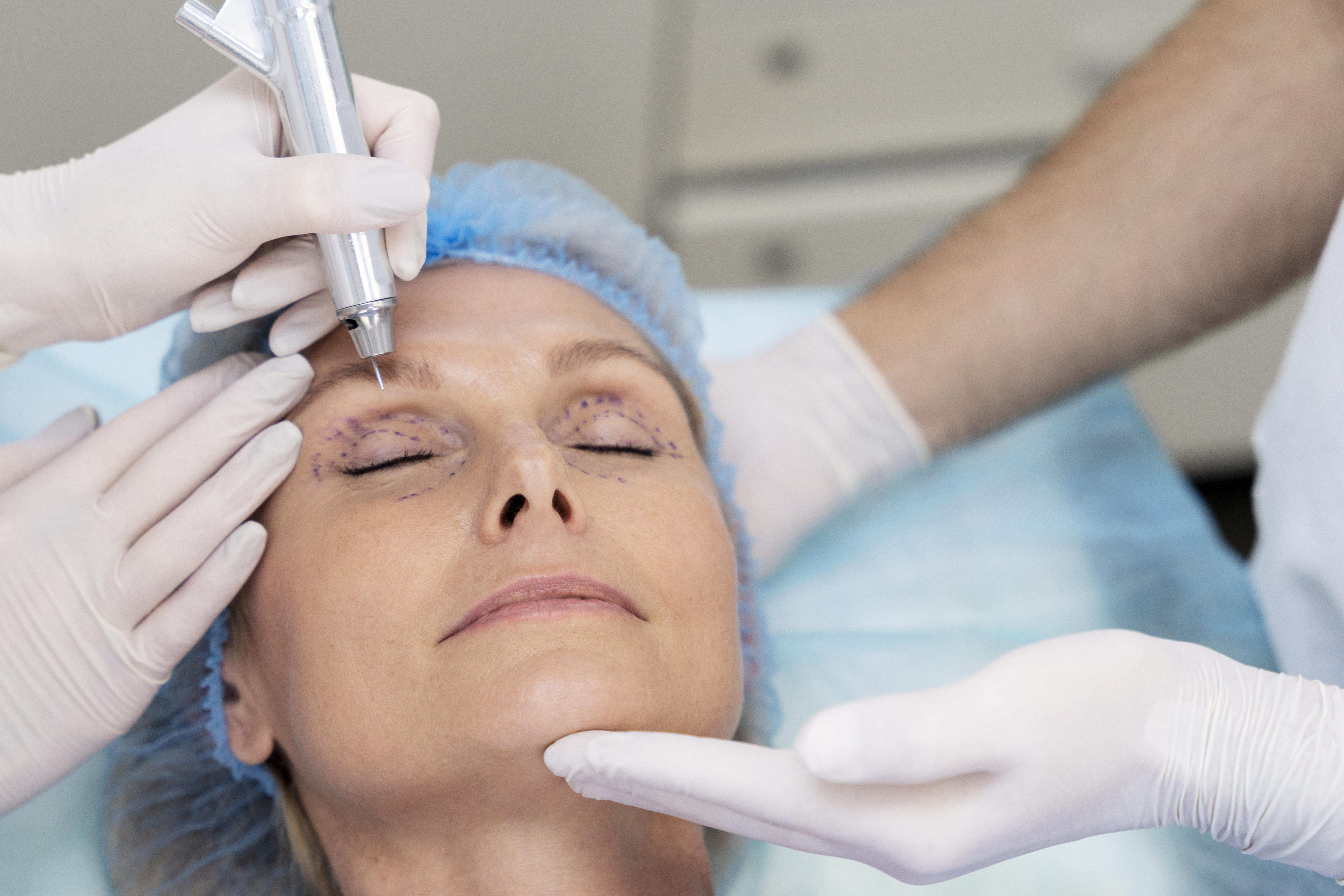Rejuvenescimento facial alia diferentes técnicas